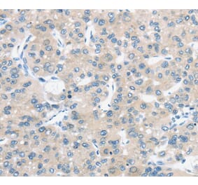 Immunohistochemistry - TM9SF1 Antibody from Signalway Antibody (40385) - Antibodies.com