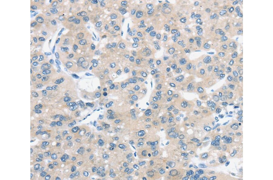 Immunohistochemistry - TM9SF1 Antibody from Signalway Antibody (40385) - Antibodies.com