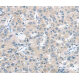 Immunohistochemistry - TM9SF1 Antibody from Signalway Antibody (40385) - Antibodies.com