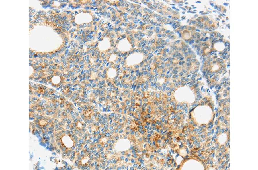 Immunohistochemistry - TM9SF1 Antibody from Signalway Antibody (40385) - Antibodies.com