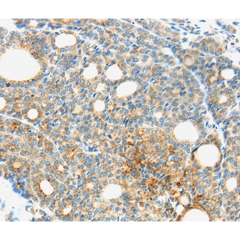 Immunohistochemistry - TM9SF1 Antibody from Signalway Antibody (40385) - Antibodies.com