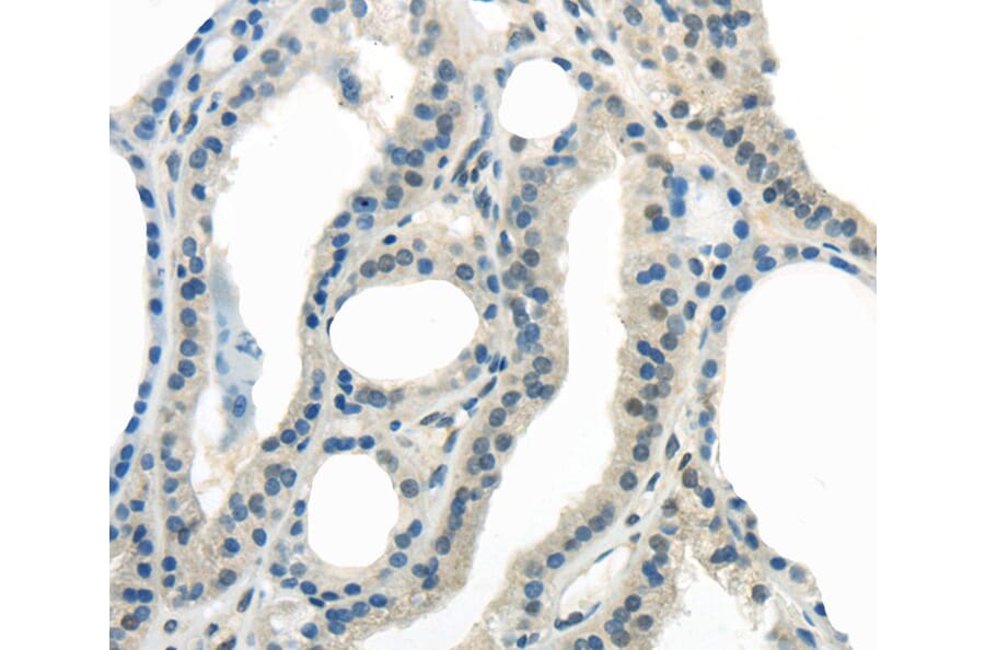 Immunohistochemistry - ENTPD1 Antibody from Signalway Antibody (40405) - Antibodies.com