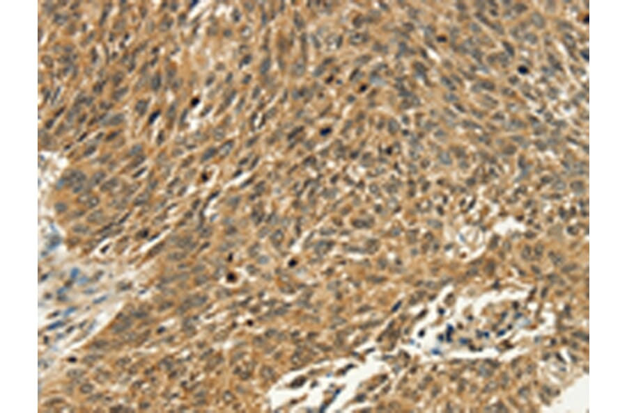 Immunohistochemistry - PSMD10 Antibody from Signalway Antibody (42712) - Antibodies.com
