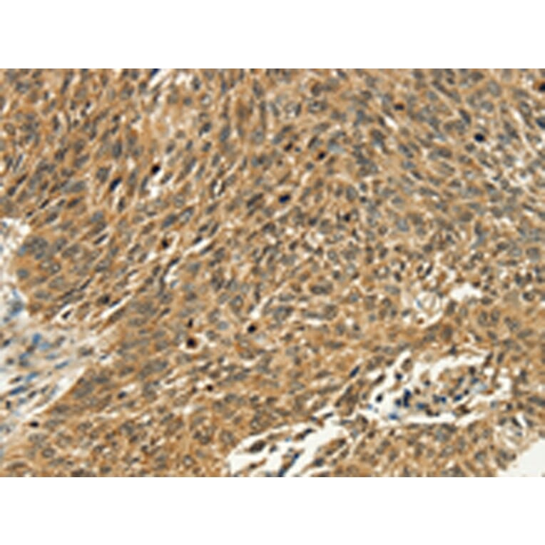 Immunohistochemistry - PSMD10 Antibody from Signalway Antibody (42712) - Antibodies.com