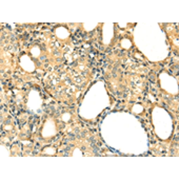 Immunohistochemistry - DNASE1 Antibody from Signalway Antibody (42716) - Antibodies.com