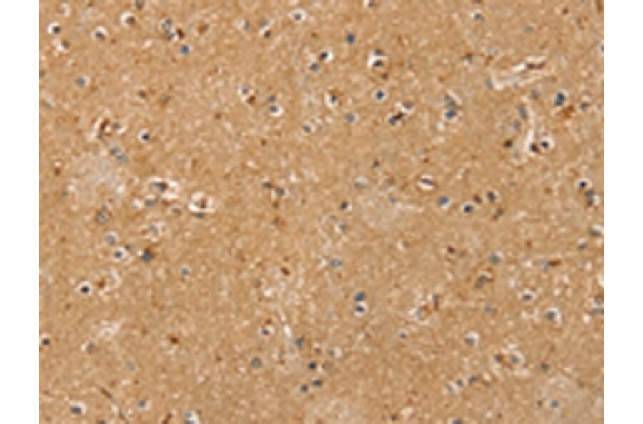 Immunohistochemistry - RASSF1 Antibody from Signalway Antibody (42729) - Antibodies.com