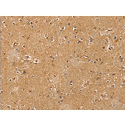 Immunohistochemistry - RASSF1 Antibody from Signalway Antibody (42729) - Antibodies.com
