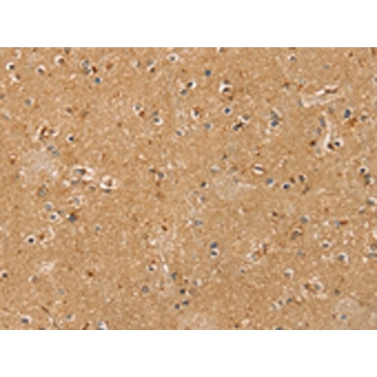 Immunohistochemistry - RASSF1 Antibody from Signalway Antibody (42729) - Antibodies.com