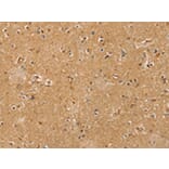 Immunohistochemistry - RASSF1 Antibody from Signalway Antibody (42729) - Antibodies.com