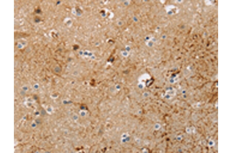 Immunohistochemistry - TRIM69 Antibody from Signalway Antibody (42739) - Antibodies.com