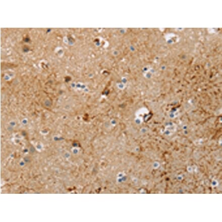Immunohistochemistry - TRIM69 Antibody from Signalway Antibody (42739) - Antibodies.com