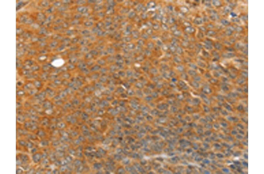 Immunohistochemistry - TRIM21 Antibody from Signalway Antibody (42767) - Antibodies.com