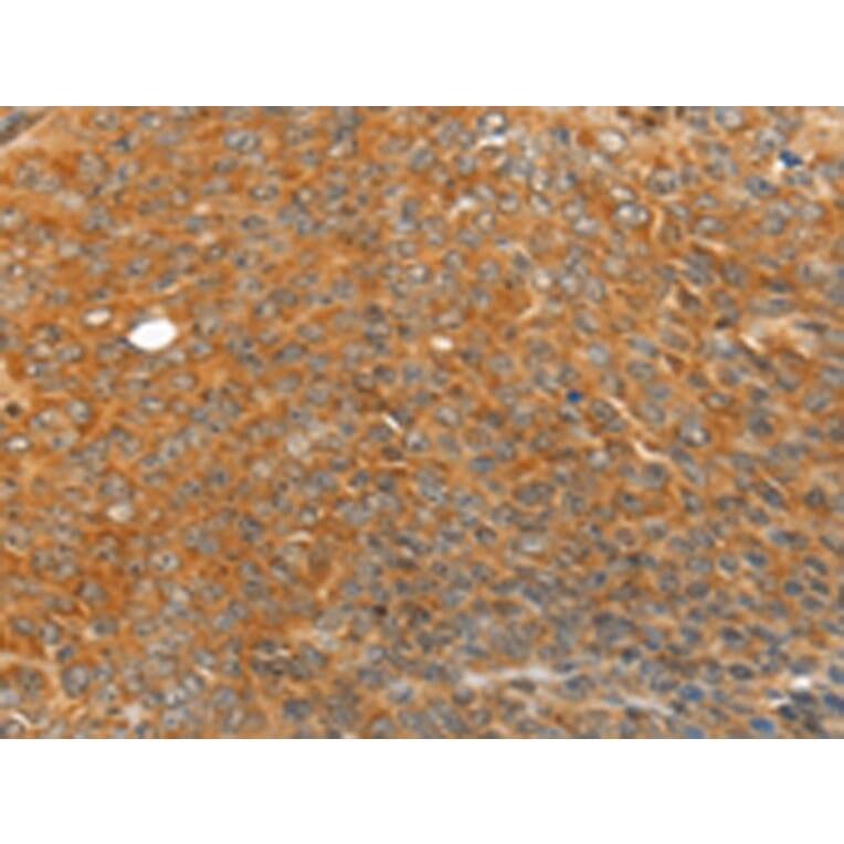 Immunohistochemistry - TRIM21 Antibody from Signalway Antibody (42767) - Antibodies.com