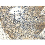 Immunohistochemistry - MAP3K7 Antibody from Signalway Antibody (42772) - Antibodies.com