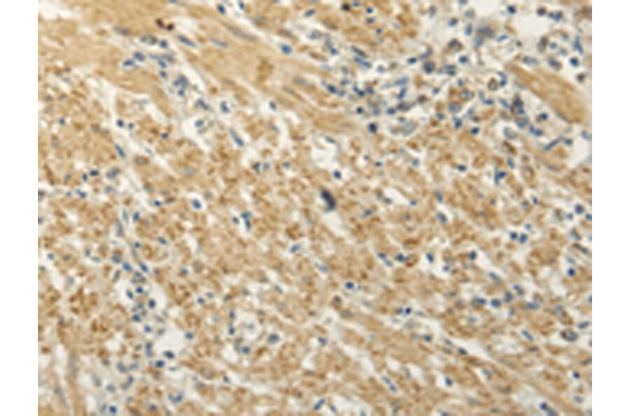 Immunohistochemistry - MAP3K7 Antibody from Signalway Antibody (42772) - Antibodies.com
