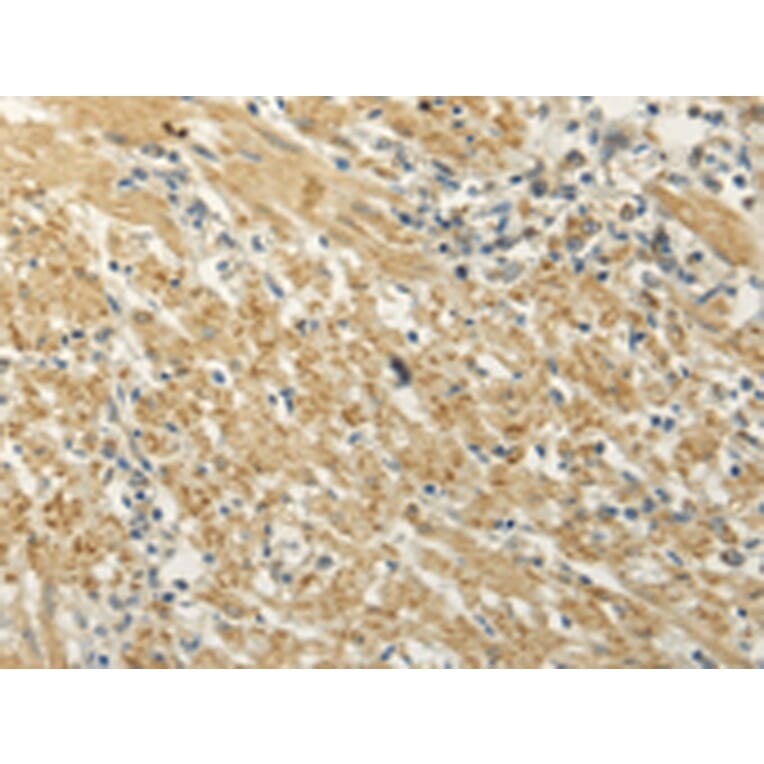 Immunohistochemistry - MAP3K7 Antibody from Signalway Antibody (42772) - Antibodies.com