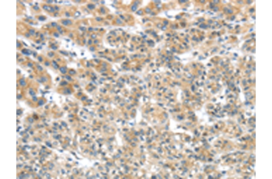 Immunohistochemistry - TRIM16 Antibody from Signalway Antibody (42781) - Antibodies.com