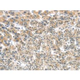 Immunohistochemistry - TRIM16 Antibody from Signalway Antibody (42781) - Antibodies.com