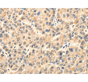 Immunohistochemistry - TWIST2 Antibody from Signalway Antibody (42798) - Antibodies.com