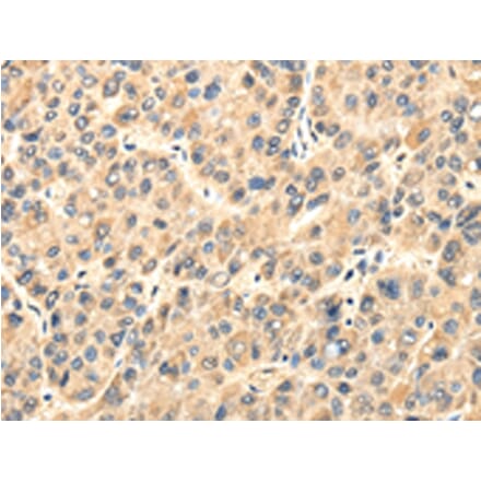 Immunohistochemistry - TWIST2 Antibody from Signalway Antibody (42798) - Antibodies.com