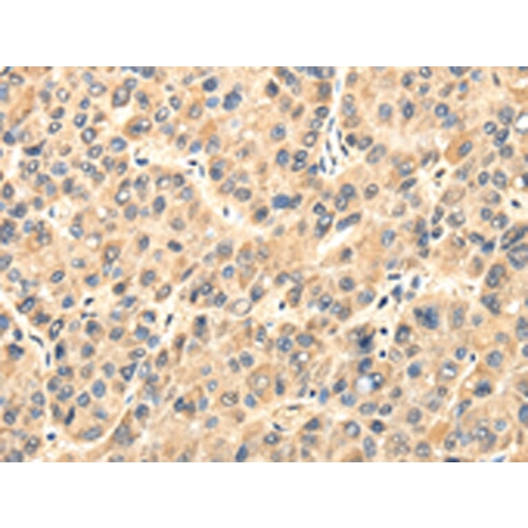 Immunohistochemistry - TWIST2 Antibody from Signalway Antibody (42798) - Antibodies.com