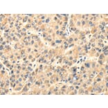 Immunohistochemistry - TWIST2 Antibody from Signalway Antibody (42798) - Antibodies.com