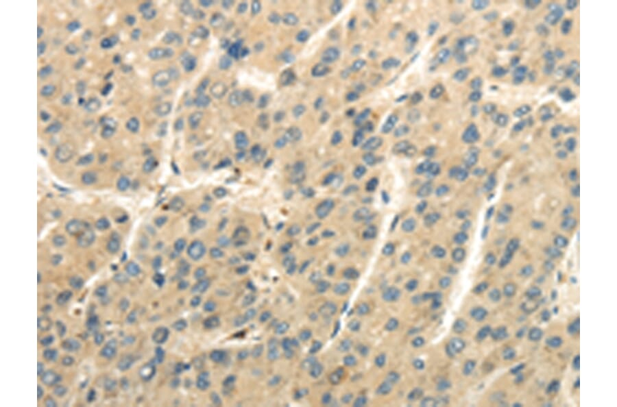 Immunohistochemistry - UBAP2L Antibody from Signalway Antibody (42800) - Antibodies.com