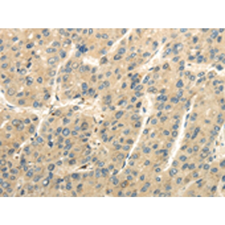 Immunohistochemistry - UBAP2L Antibody from Signalway Antibody (42800) - Antibodies.com