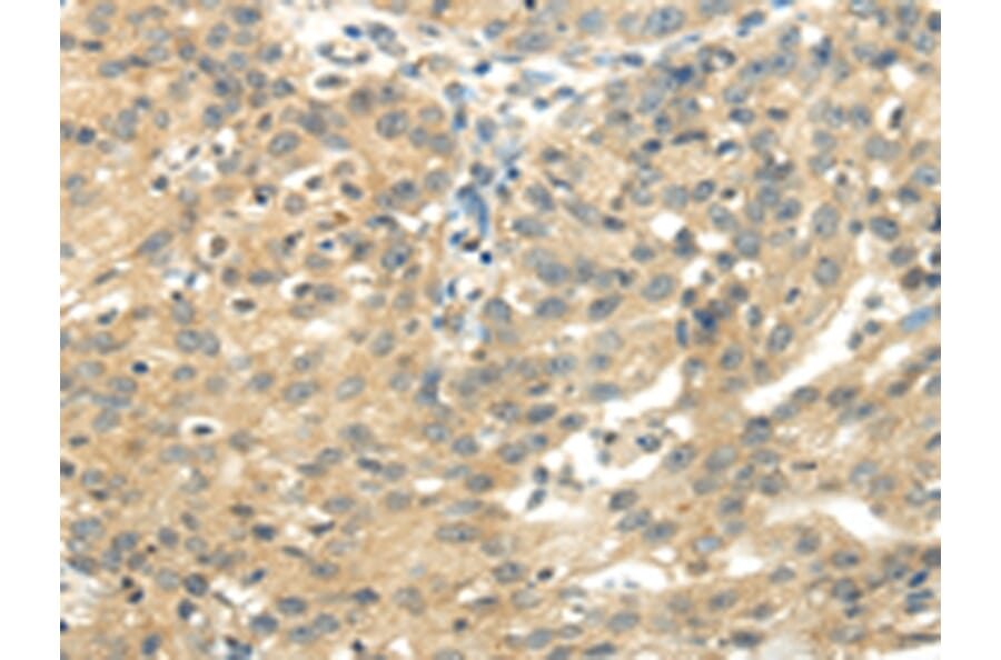 Immunohistochemistry - UBAP2L Antibody from Signalway Antibody (42800) - Antibodies.com