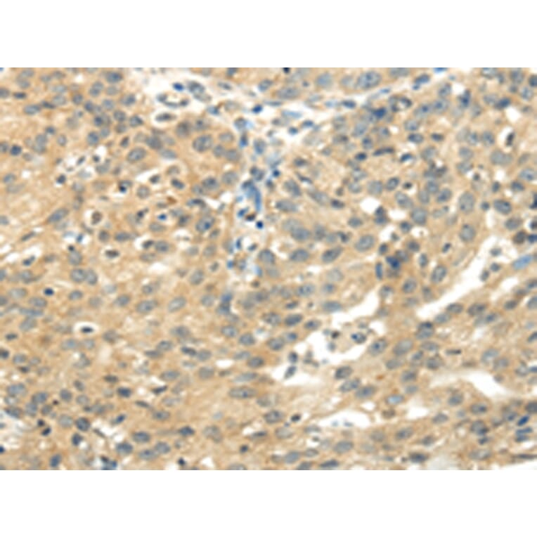 Immunohistochemistry - UBAP2L Antibody from Signalway Antibody (42800) - Antibodies.com