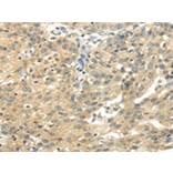 Immunohistochemistry - UBAP2L Antibody from Signalway Antibody (42800) - Antibodies.com