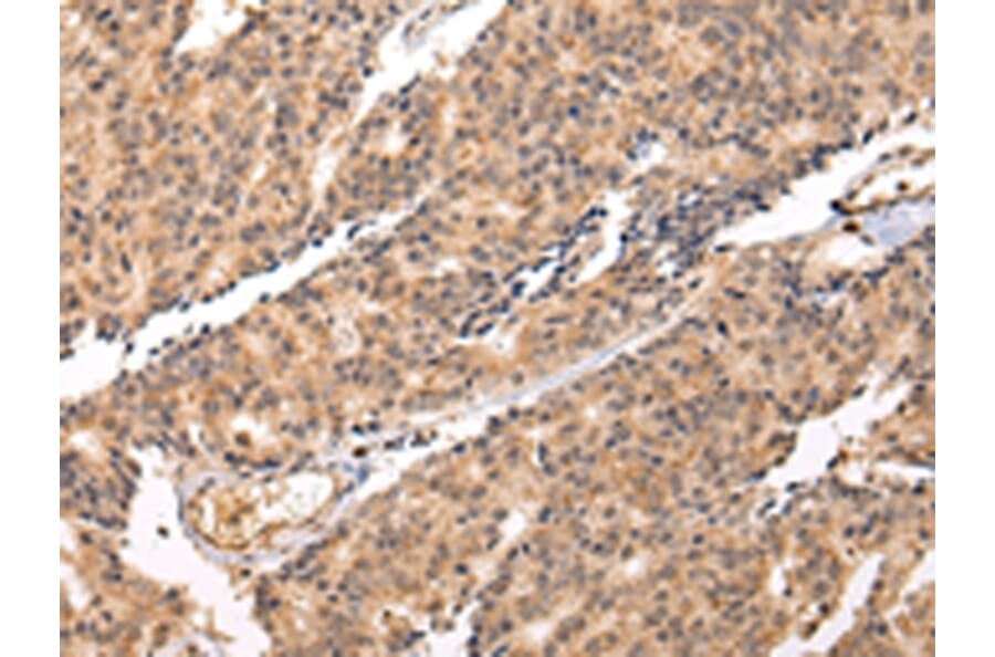 Immunohistochemistry - SWAP70 Antibody from Signalway Antibody (42812) - Antibodies.com