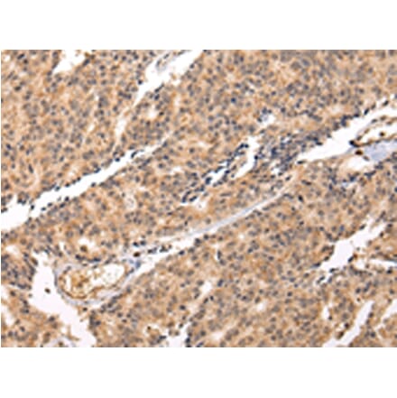 Immunohistochemistry - SWAP70 Antibody from Signalway Antibody (42812) - Antibodies.com