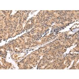 Immunohistochemistry - SWAP70 Antibody from Signalway Antibody (42812) - Antibodies.com
