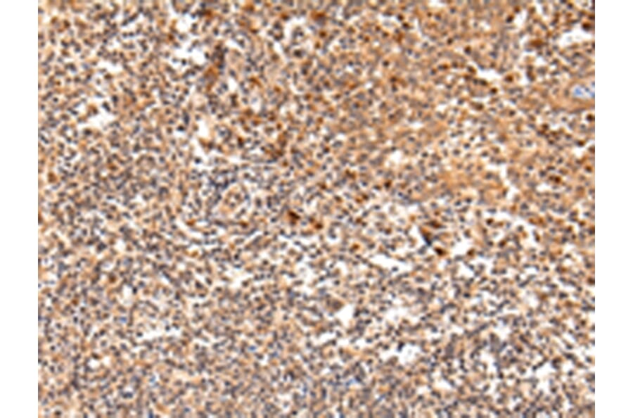 Immunohistochemistry - SWAP70 Antibody from Signalway Antibody (42812) - Antibodies.com
