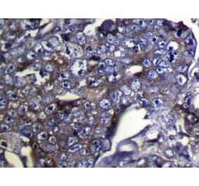 Immunohistochemistry - DUSP11 Antibody from Signalway Antibody (42819) - Antibodies.com