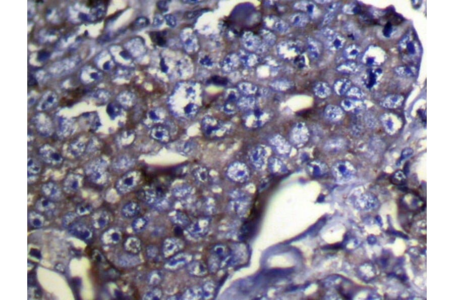 Immunohistochemistry - DUSP11 Antibody from Signalway Antibody (42819) - Antibodies.com