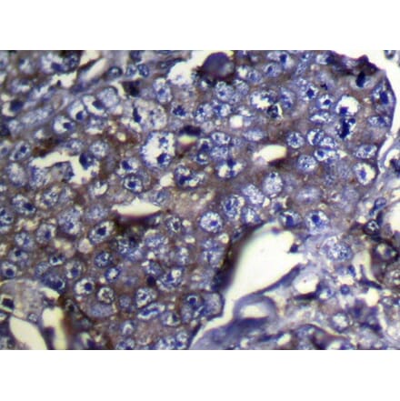 Immunohistochemistry - DUSP11 Antibody from Signalway Antibody (42819) - Antibodies.com