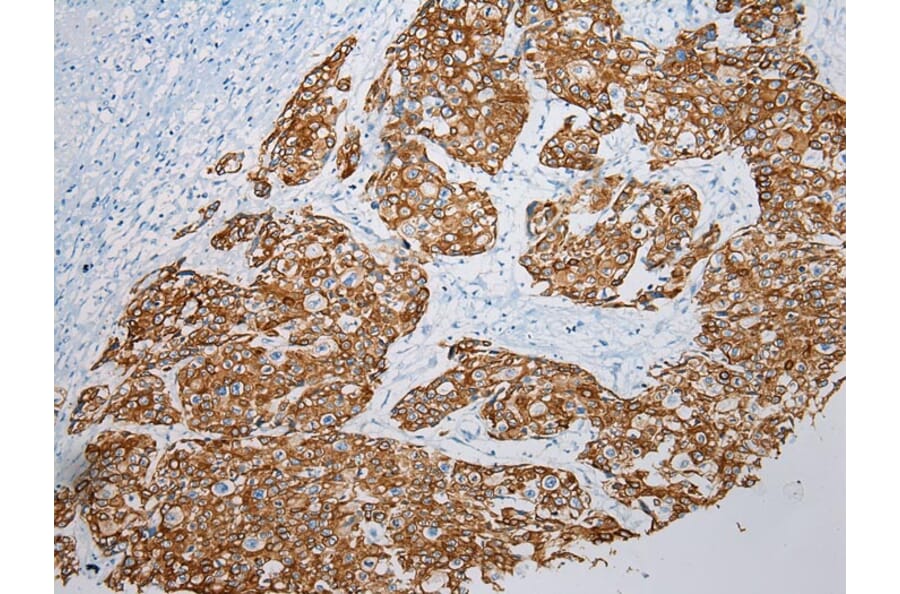 Immunohistochemistry - VPS33A Antibody from Signalway Antibody (42842) - Antibodies.com