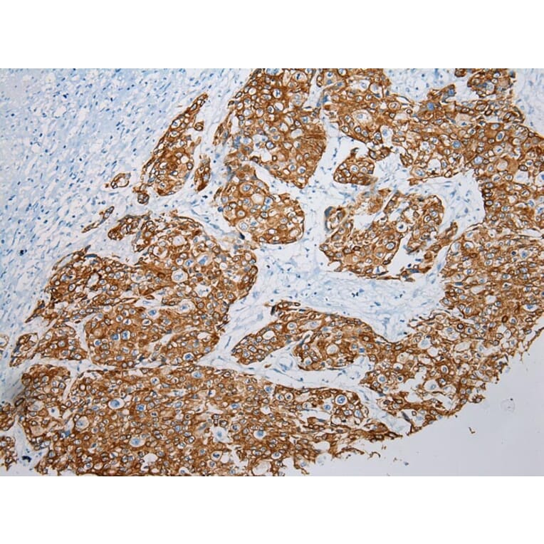 Immunohistochemistry - VPS33A Antibody from Signalway Antibody (42842) - Antibodies.com