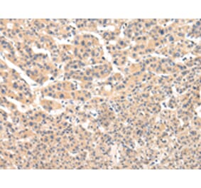 Immunohistochemistry - VPS33B Antibody from Signalway Antibody (42843) - Antibodies.com