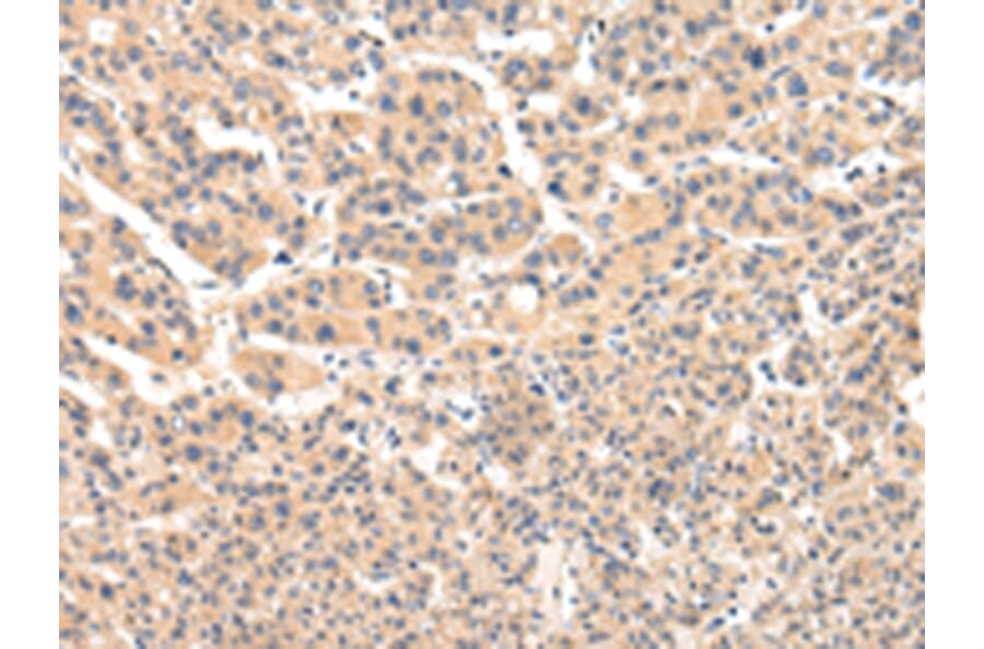 Immunohistochemistry - VPS33B Antibody from Signalway Antibody (42843) - Antibodies.com