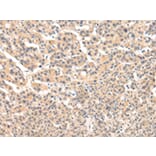 Immunohistochemistry - VPS33B Antibody from Signalway Antibody (42843) - Antibodies.com