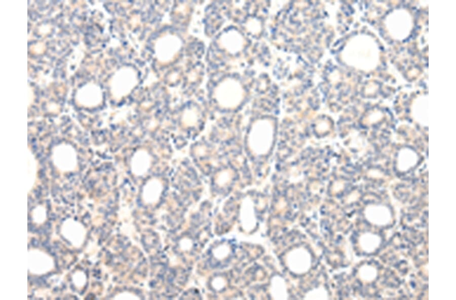 Immunohistochemistry - VPS33B Antibody from Signalway Antibody (42843) - Antibodies.com