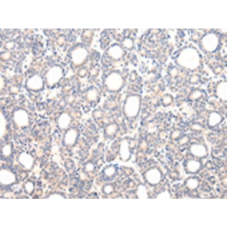 Immunohistochemistry - VPS33B Antibody from Signalway Antibody (42843) - Antibodies.com