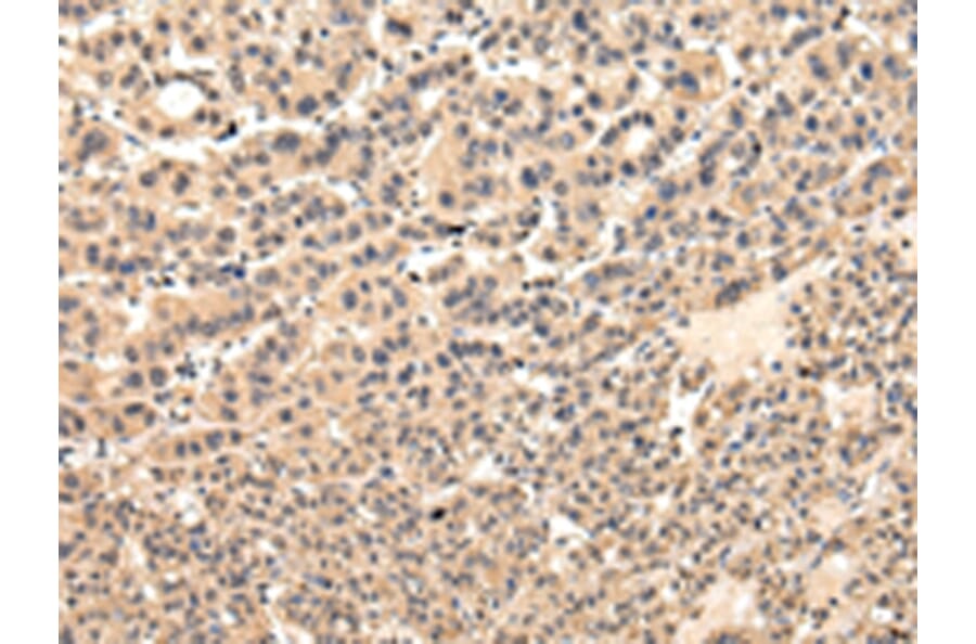 Immunohistochemistry - VPS37D Antibody from Signalway Antibody (42845) - Antibodies.com