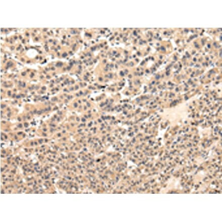Immunohistochemistry - VPS37D Antibody from Signalway Antibody (42845) - Antibodies.com