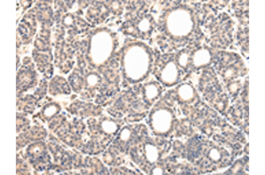 Immunohistochemistry - VPS37D Antibody from Signalway Antibody (42845) - Antibodies.com