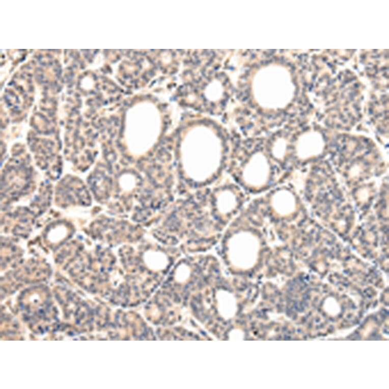 Immunohistochemistry - VPS37D Antibody from Signalway Antibody (42845) - Antibodies.com