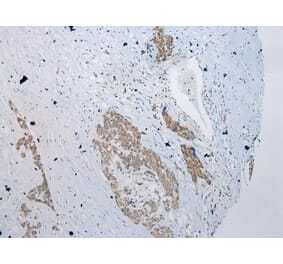 Immunohistochemistry - YY1AP1 Antibody from Signalway Antibody (42866) - Antibodies.com